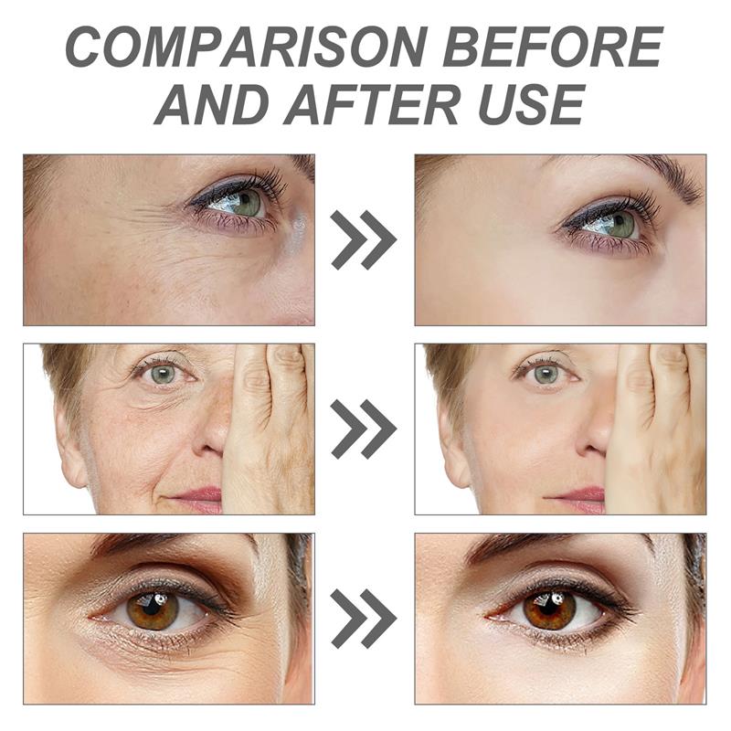 Suero Facial con Retinol para  - Milk Thistle Silymarin reseña y precio